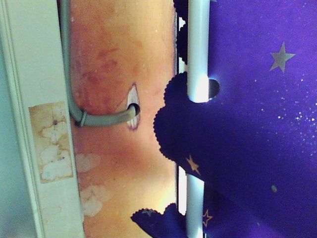 行方市、雨漏り原因だったシーリングの劣化！撤去してシーリングに合うボンドブレーカーを設置。二面接着で長寿命化！